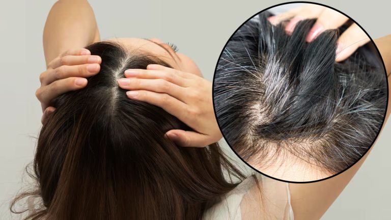 Fini les cheveux gris : découvrez cette méthode naturelle pour rajeunir votre apparence